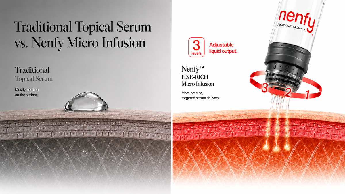Micro Infusion, Explained